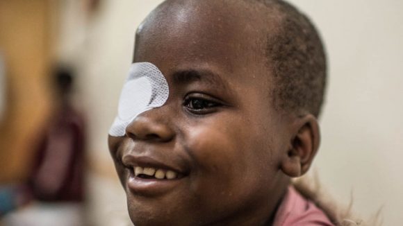 Un bambino con la benda sull'occhio sorride.