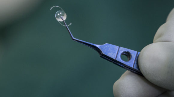A close-up of the plastic lens that's implanted into the eye during a cataract operation.