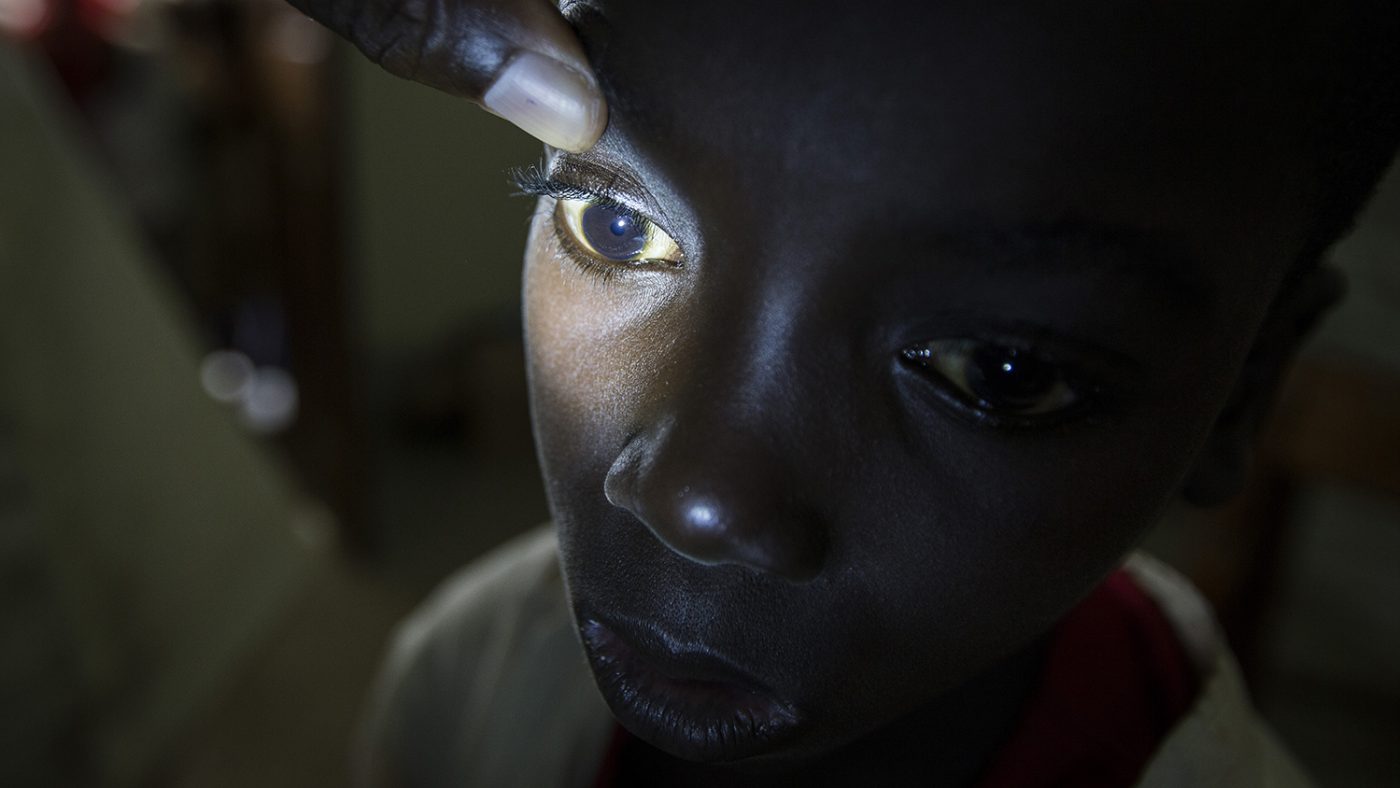 An eye screening worker shines a light into a boy's eyes to check for eye problems.