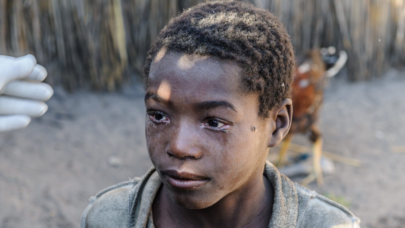 Un ragazzino guarda davanti a sè con gli occhi gonfi di lacrime.