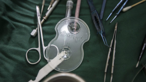 Materiale per l'operazione di cataratta su un tavolo