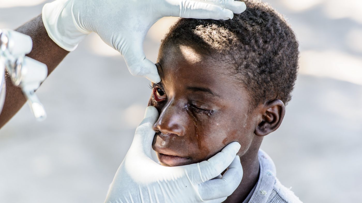 Nananga viene visitato agli occhi mentre gli scendono le lacrime causate dal dolore del tracoma.