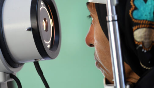 Close up of a lady having her eye examined.