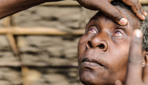 A woman with trachoma has her eyes examined.