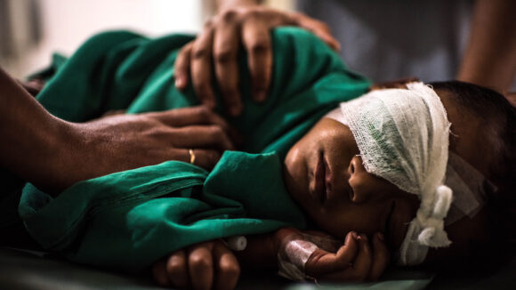 bambino dopo operazione cataratta