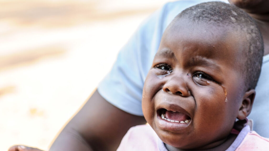 Obri piange disperata per il dolore causato dal tracoma.