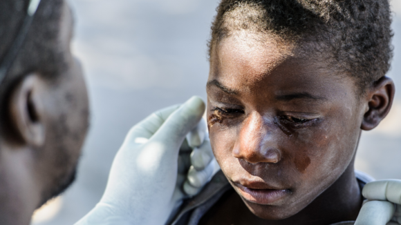 Nananga viene visitato agli occhi.