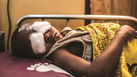 Bambino con bende sugli occhi sdraiato su un lettino di ospedale.