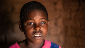 La piccola melia in primo piano con gli occhi opachi.