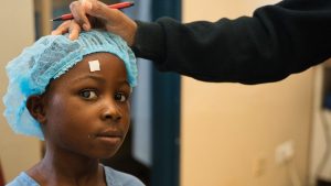Una bambina in primo piano con la cuffia da ospedale ha la cataratta negli occhi.